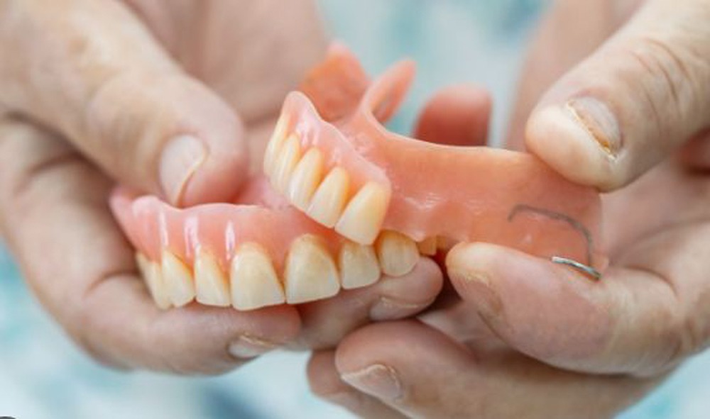 5 Hal yang Perlu Kamu Ketahui Sebelum Menggunakan Gigi Palsu