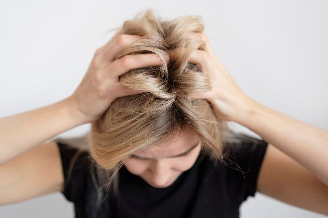 Rambut Sehat Bebas Kutu, 5 Cara Menghilangkan Kutu Rambut Menggunakan Minyak Zaitun