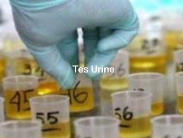 Tes Urine Massal ASN dan DPRD Kepahiang Batal