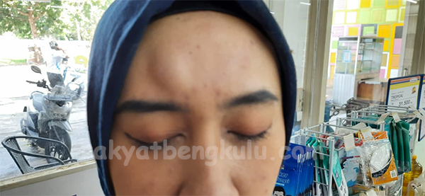 Kasir Cantik Ini Sampai Benjol Dibogem Calon Pembeli