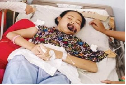 Gadis Malang Puja Butuh Uluran Tangan, Dokter di Bengkulu sudah Angkat Tangan