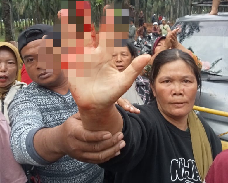 Pecah! Bentrok Antara Warga dan Karyawan PT Agricinal Sebabkan Korban Luka