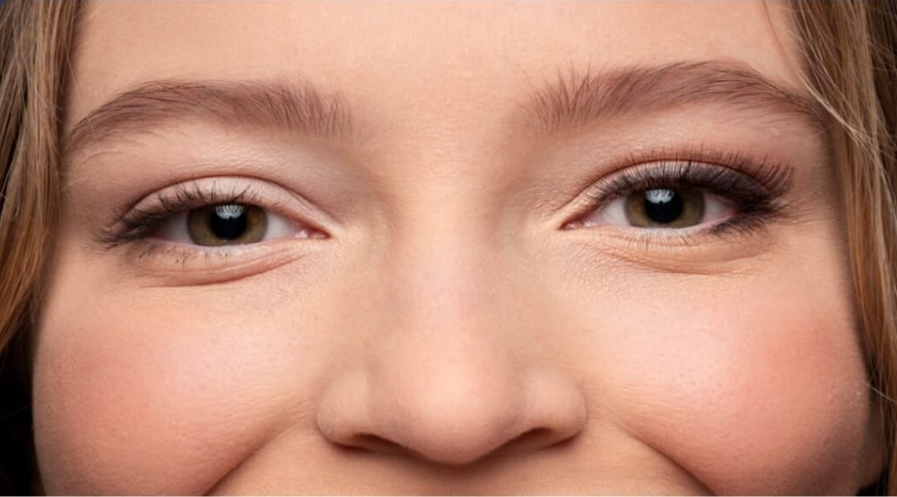 Mata Besar Sebelah Berpengaruh Terhadap Kesehatan? Kenali Penyebabnya