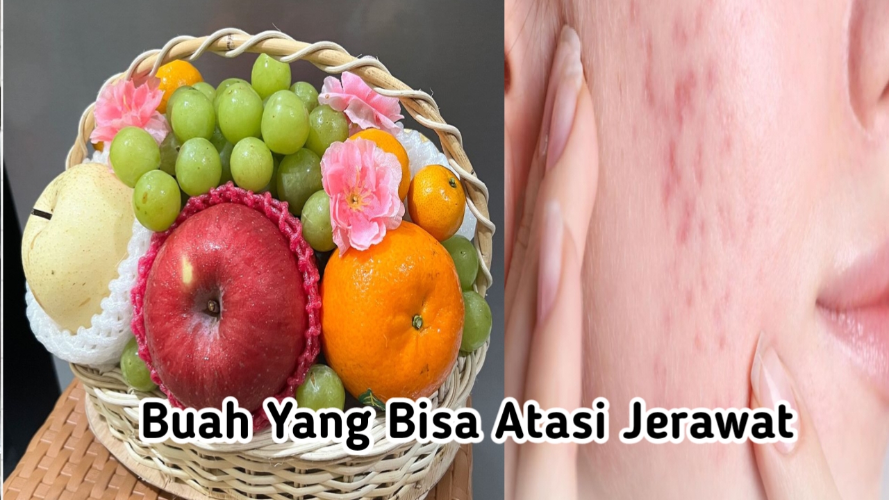 8 Buah yang Bagus untuk Atasi Masalah Jerawat, Miliki Nutrisi yang Baik untuk Kulit