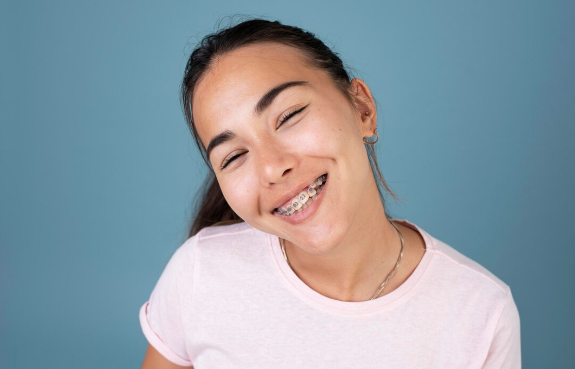 Tips Memakai Behel! Pentingnya Menjaga Kesehatan Gigi dan Mulut Kamu