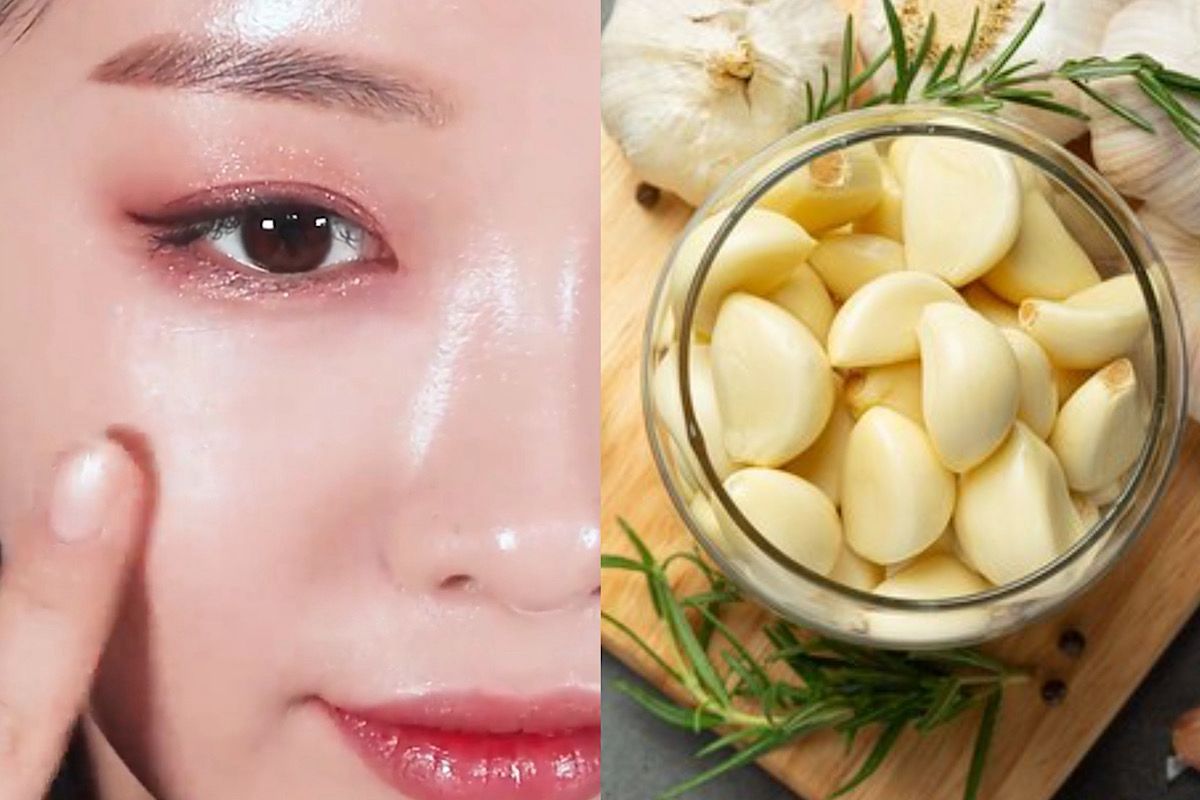 Rahasia Keampuhan Masker Bawang Putih untuk Kulit Bersinar Alami: Ini Cara Penggunaannya