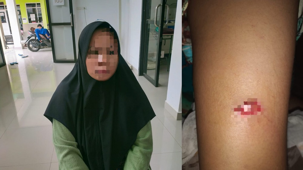 Ditikam Tetangga dan Handphone Dirampas, Wanita di Rejang Lebong Alami Luka, Pelaku Buron