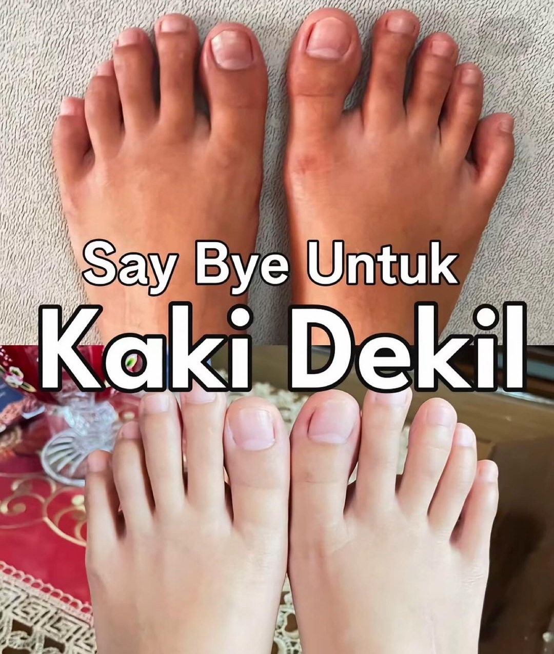 4 Cara Mudah Membuat Kaki Glowing: Jadikan Rutinitas Harian untuk Hasil Maksimal