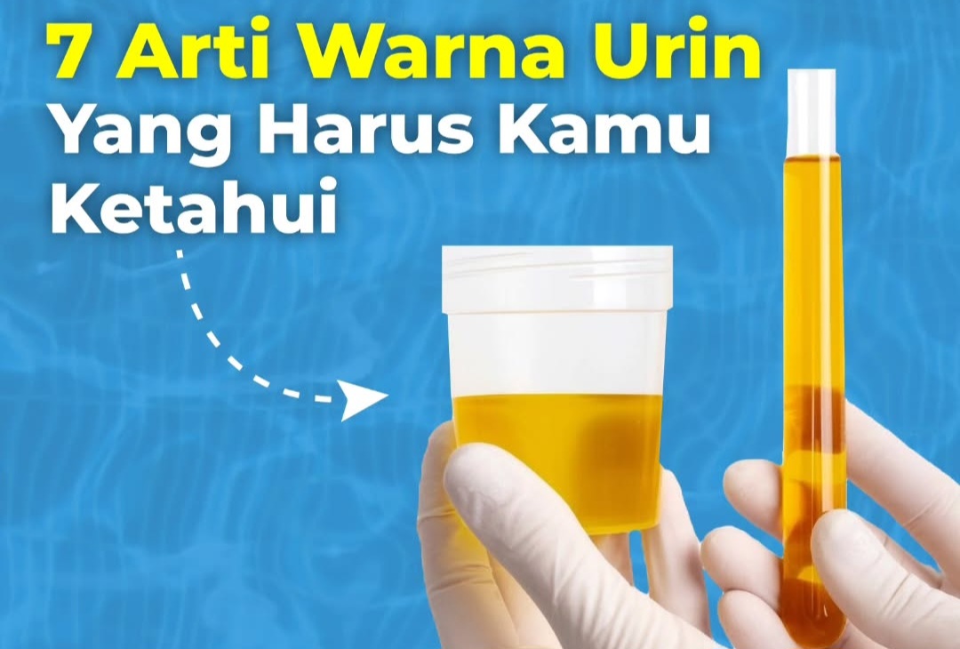 7 Arti Warna Urin yang Perlu Diketahui, Apa yang Ditunjukkan oleh Warna Urin Anda?