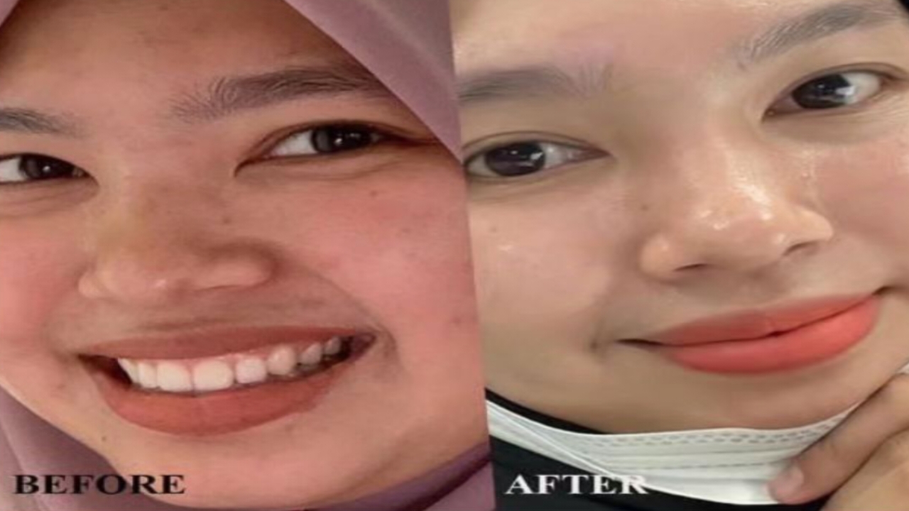 5 Masker Alami yang Efektif untuk Memutihkan Wajah Secara Alami, Beserta Cara Membuatnya!