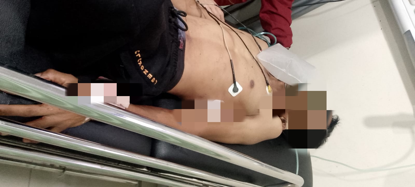 Satpam DPRD Bengkulu Jadi Korban Begal, Dibacok dan Motornya Raib