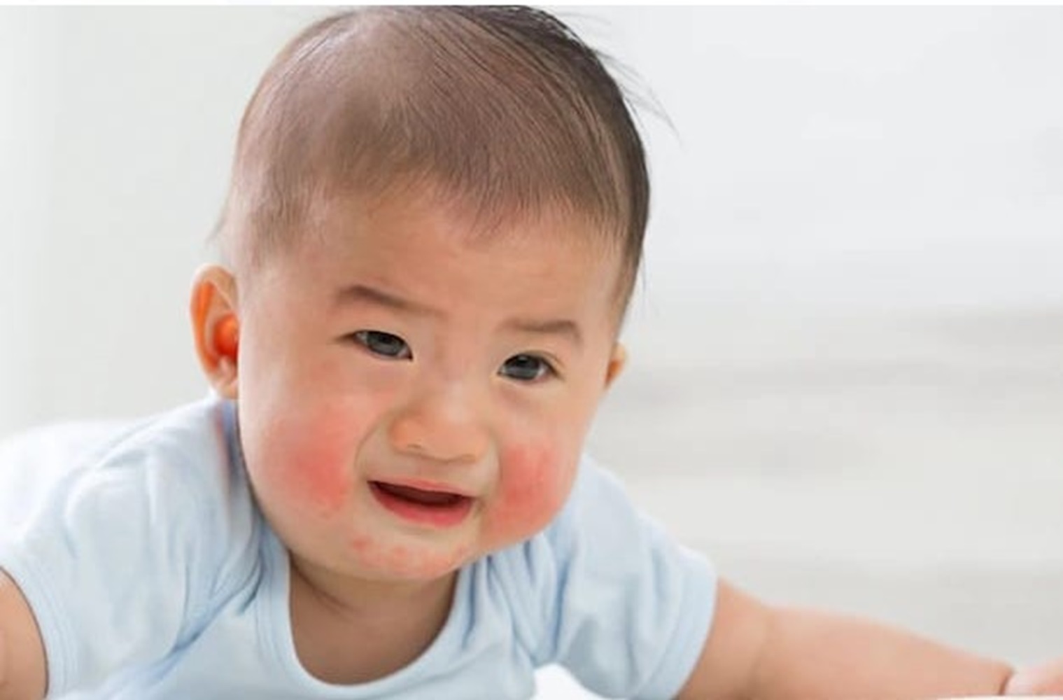 Hati-hati! Bayi Bisa Alergi Makanan, Menangis Terus Menerus, Muncul Biduran