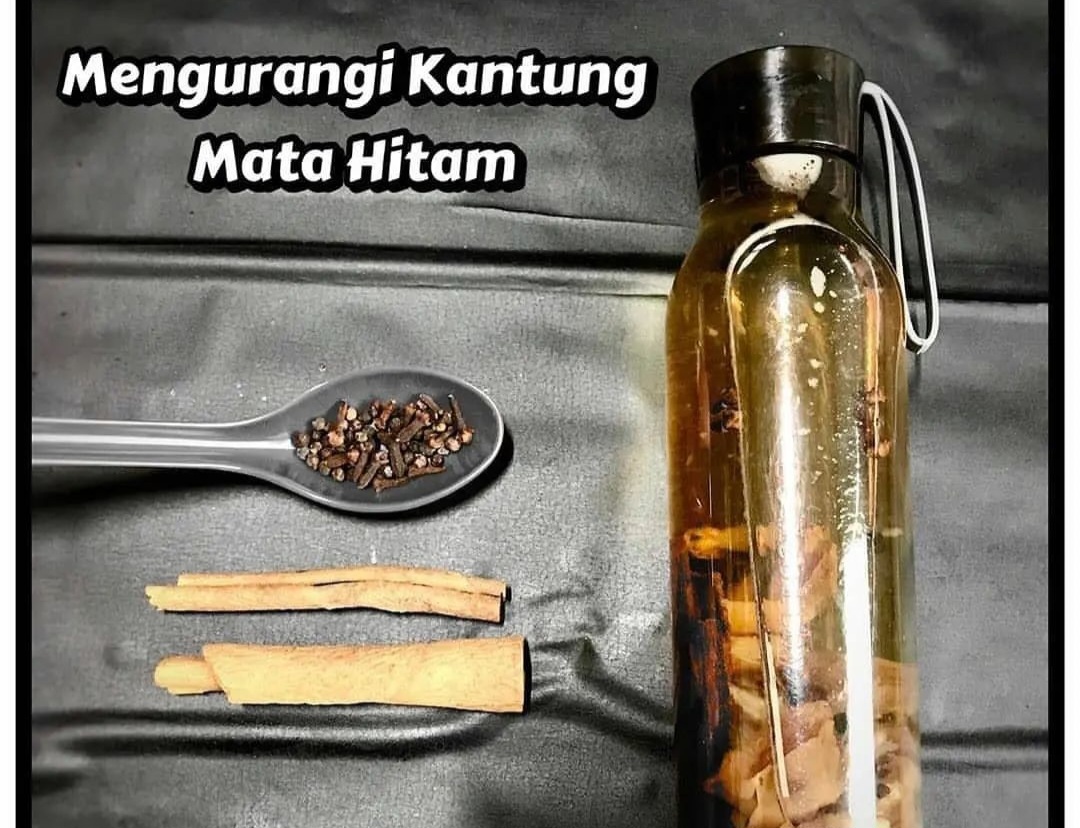 Kantung Mata Hitam: Tanda Gangguan Kesehatan dan Cara Mengatasinya