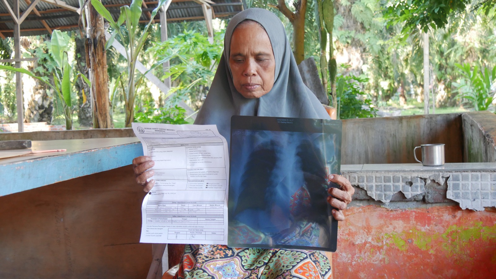 Kondisi Kesehatan Warga di Teluk Sepang Kota Bengkulu Semakin Terancam Akibat Dampak Batubara