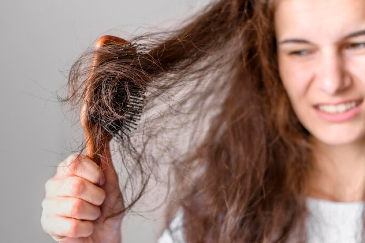 Rambut Rontok Terus Menerus? Begini Cara Mengatasi dan Penjelasannya