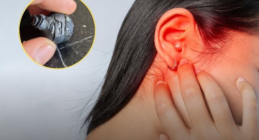 Waspada! Kebiasaan Pakai Earphone Bisa Picu Peradangan Telinga