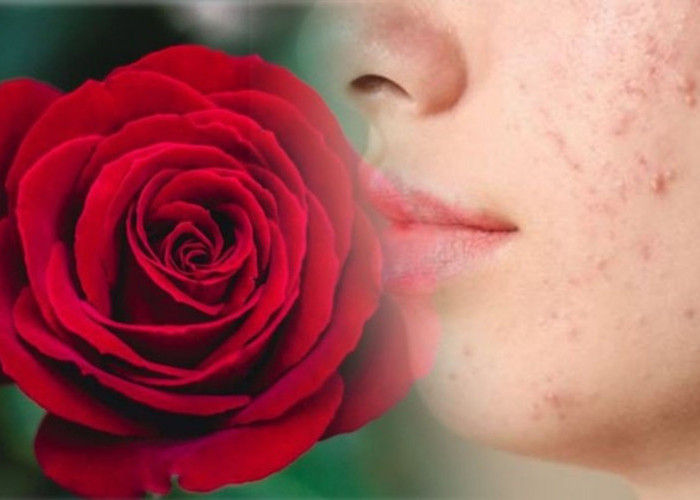 Manfaat Bunga Mawar, Mengatasi Tanda Penuaan Kulit, Menyembuhkan Infeksi Kulit