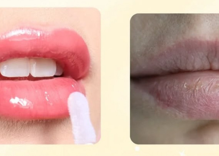 Bibir Hitam? Ini Rahasia Alami Bikin Bibir Kembali Pink dan Lembab, Coba Yuk!