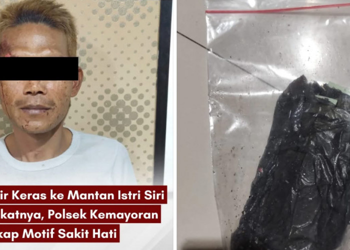 Cemburu Membara, Mantan Suami Siram Air Keras ke Istri Siri dan Pria Lain