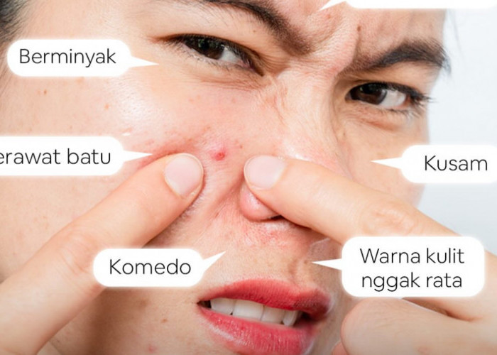 Masker DIY untuk Kulit Berjerawat dan Sensitif: Tren Kecantikan di TikTok yang Wajib Kamu Coba!