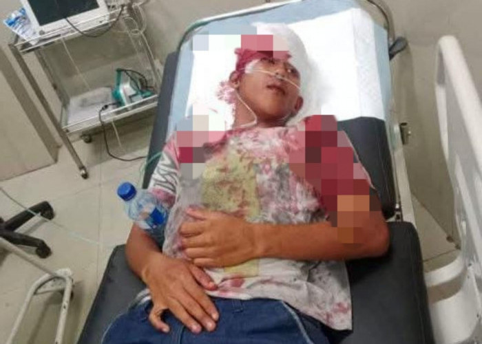 Geng Motor Brutal Beraksi di Bengkulu, Dua Pemuda Dibacok dan Dipukul Botol