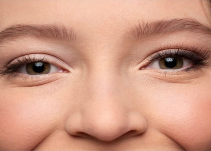 Mata Besar Sebelah Berpengaruh Terhadap Kesehatan? Kenali Penyebabnya