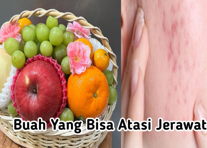 8 Buah yang Bagus untuk Atasi Masalah Jerawat, Miliki Nutrisi yang Baik untuk Kulit