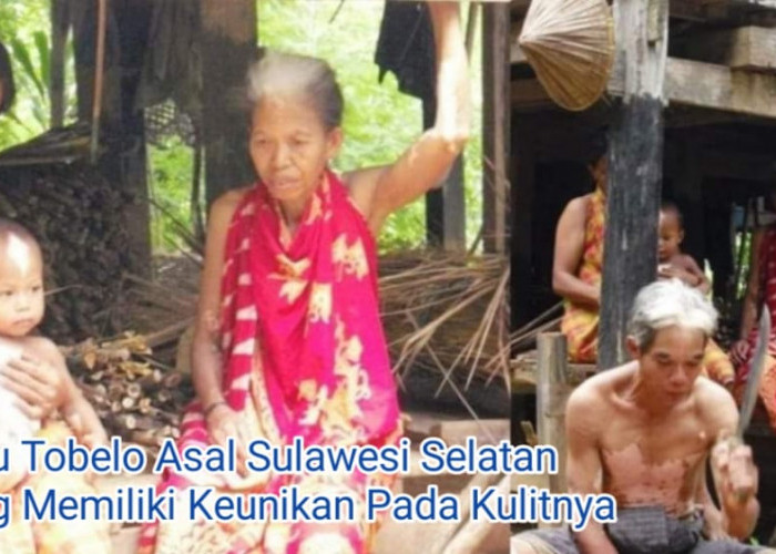 Ini 7 Fakta Unik Suku Tobalo Sulawesi Selatan yang Memiliki Kulit Belang Berwarna Putih 