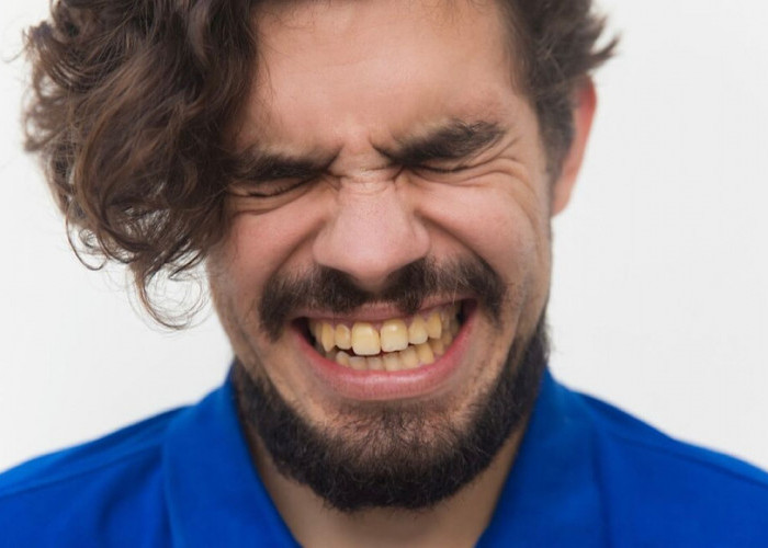 Begini Cara Merawat Gigi Agar Tidak Kuning: Tips untuk Senyum Putih Berseri