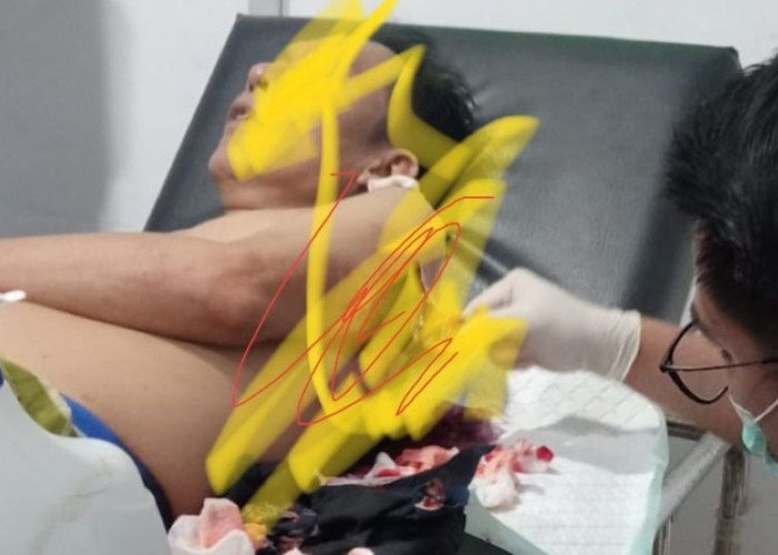 Kades Padang Genteng Dibacok OTK Usai Hadiri Resepsi Pernikahan, Polisi Kantongi Identitas Pelaku