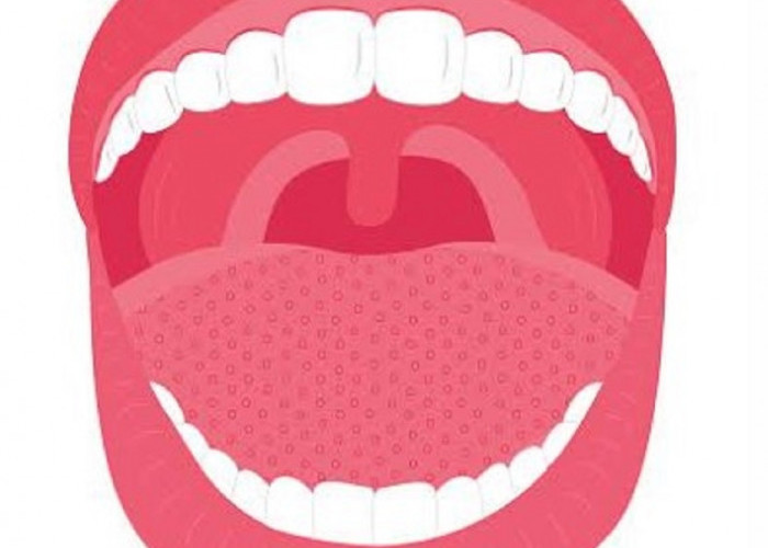 Kuman Penyebab Sakit Gigi dan Gusi Bisa Sebabkan Infeksi Mulut, Sikat Gigi Teratur dan Gunakan Mouthwash