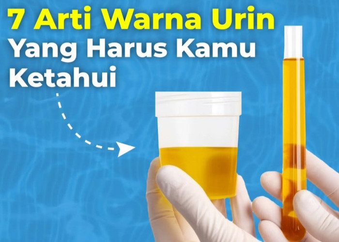 7 Arti Warna Urin yang Perlu Diketahui, Apa yang Ditunjukkan oleh Warna Urin Anda?