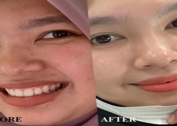 5 Masker Alami yang Efektif untuk Memutihkan Wajah Secara Alami, Beserta Cara Membuatnya!