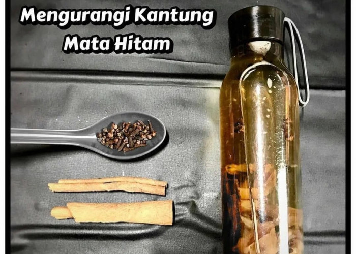 Kantung Mata Hitam: Tanda Gangguan Kesehatan dan Cara Mengatasinya