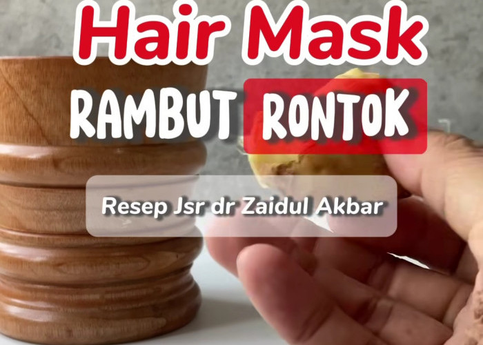 Mau Hindari Kebotakan? Begini Tips yang Diajarkan dr. Zaidul Akbar