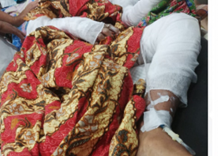TRAGEDI Gas 3 Kg  di Rejang Lebong - Bengkulu, Sekeluarga Luka Bakar Serius