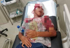 Geng Motor Brutal Beraksi di Bengkulu, Dua Pemuda Dibacok dan Dipukul Botol