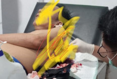 Kades Padang Genteng Dibacok OTK Usai Hadiri Resepsi Pernikahan, Polisi Kantongi Identitas Pelaku